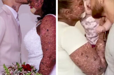 Una mujer es llamada ‘irresponsable’ por tener un bebé con su condición de piel, ella muestra a su ‘hermosa’ pequeña.