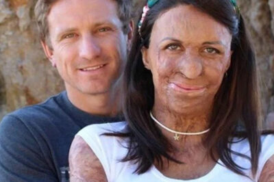 Después de que un incendio dañara la belleza de su esposa, el esposo se niega a abandonarla.
