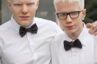La Impactante Apariencia de la Madre de Estos Hermanos Albinos: ¡Una Familia que Sorprende al Mundo!