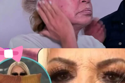 Laura Bozzo se hace retoque estético en el rostro, muestra resultados en vivo y causa polémica con nueva cara.