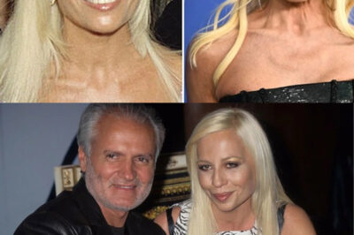 ¿Cómo se veía la diseñadora de moda italiana Donatella Versace antes de la cirugía plástica?