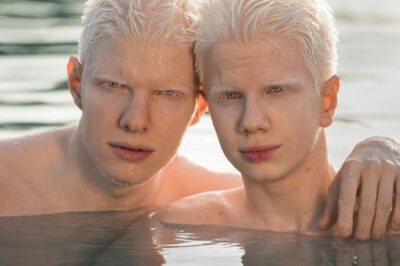 ¿Cómo Luce La Madre De Estos Hermanos Albinos?: “Familia Inusual”