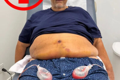 Raúl de Molina detalla que casi fallece tras delicada cirugía: “Estaba botando liquido rojo por todos lados… Mía llamó al 911”
